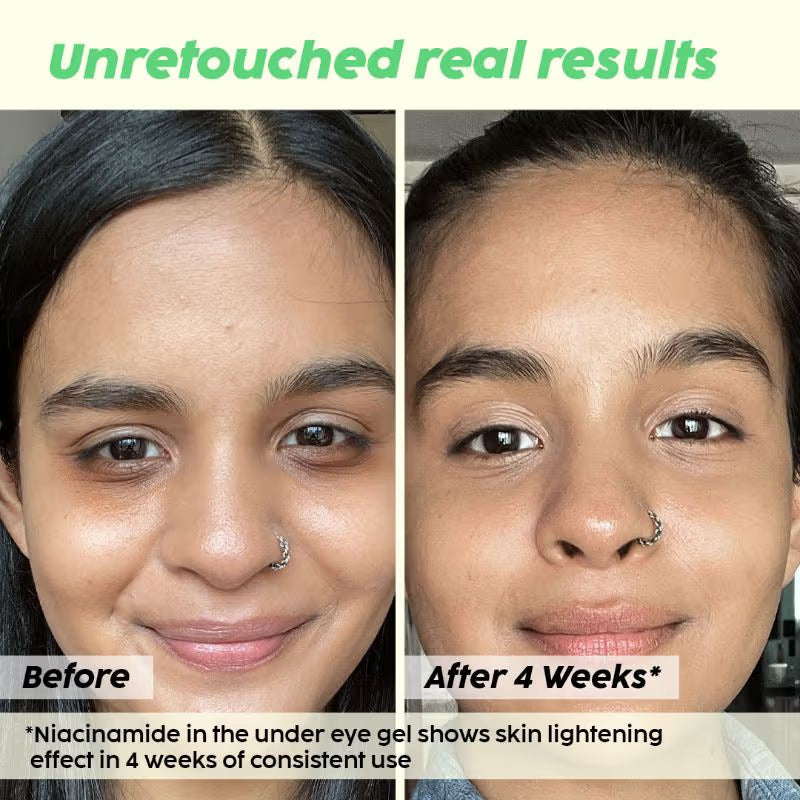 PLIX Guava Under-Eye Gel For Reducing Dark Circles
