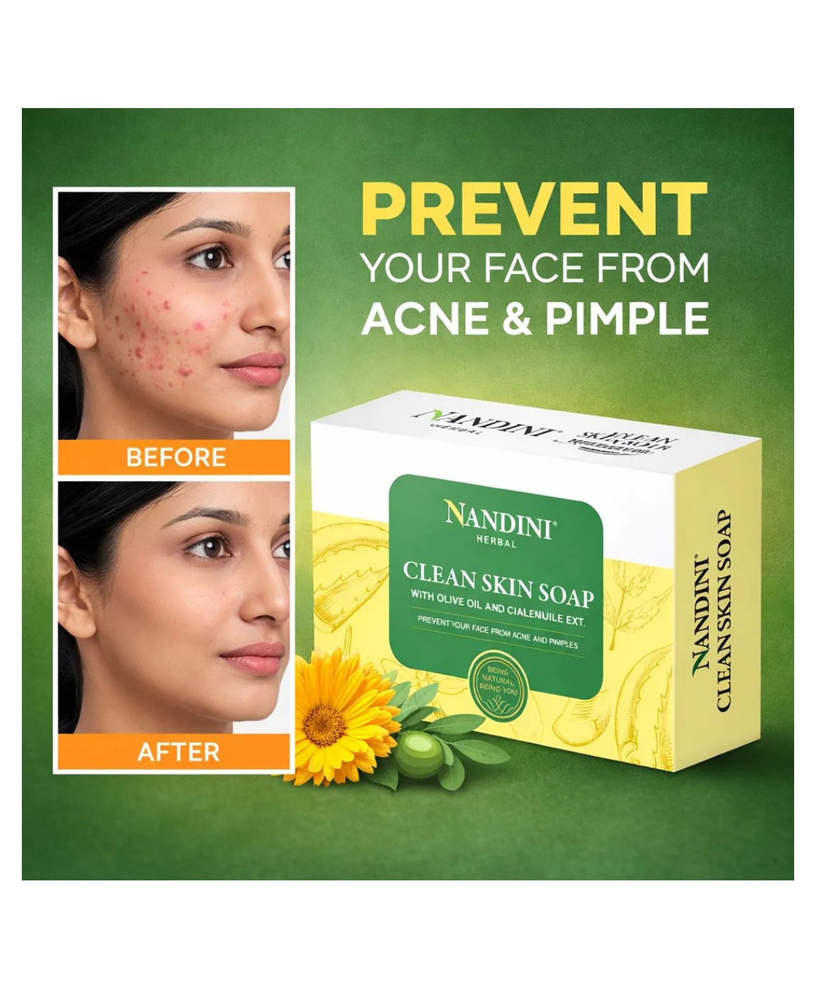 Nandini Herbal Clean skin Soap, For Acne & Pimples