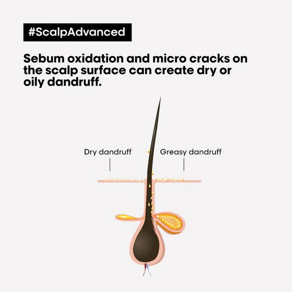 Loreal Professionnel Scalp Advanced Anti Dandruff Shampoo